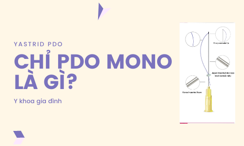 Chỉ PDO Mono là gì? Chỉ PDO Mono là gì?