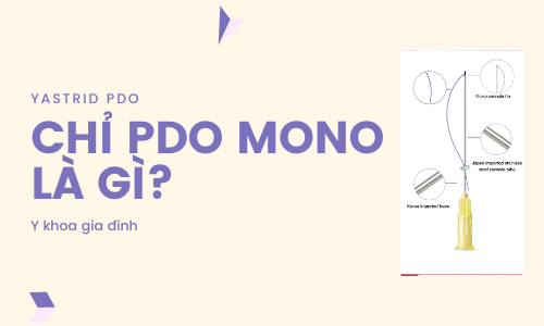 Chỉ PDO Mono là gì?