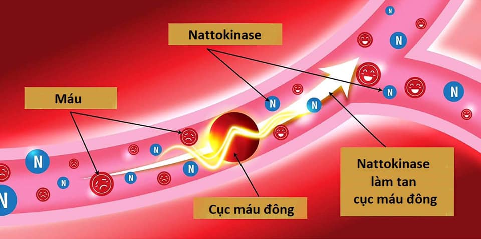 VÌ SAO NGƯỜI CÓ TIỀN SỬ HOẶC CÓ NGUY CƠ BỆNH TIM MẠCH NÊN DÙNG NATTO H | Mangala.com.vn