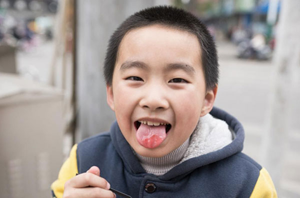 trẻ nhỏ sâu răng