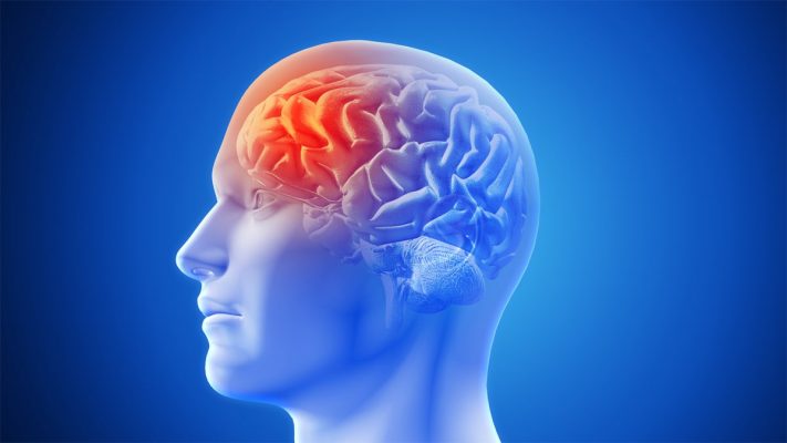 Thuốc chống đột quỵ 1 viên duy nhất – An cung Thuốc chống đột quỵ 1 viên duy nhất – An cung