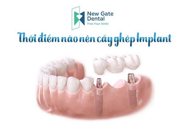 Nha Khoa New Gate | Hospitalsbox.com