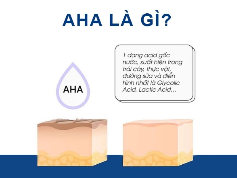 aha la gi 1