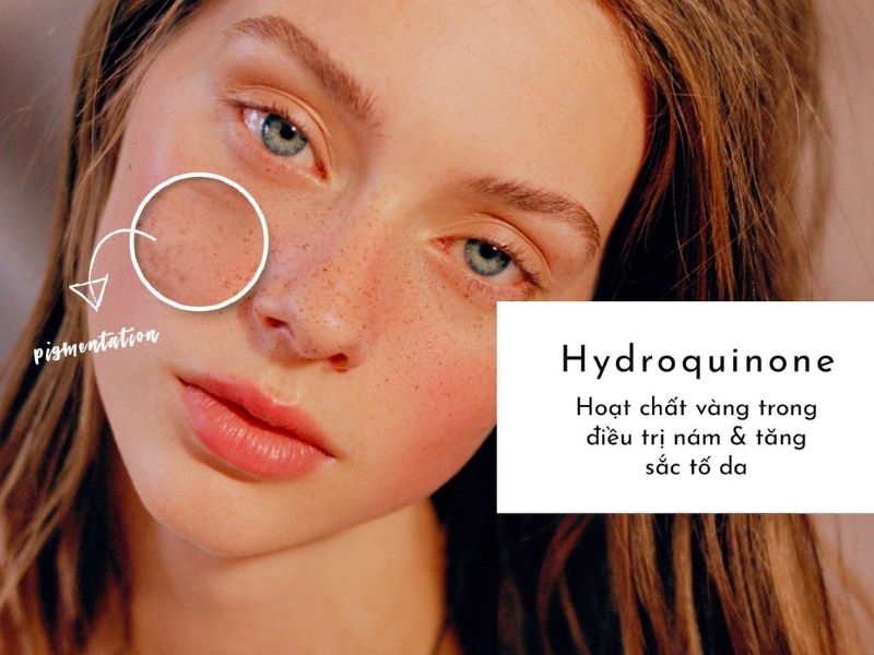 hydroquinone la gi 1
