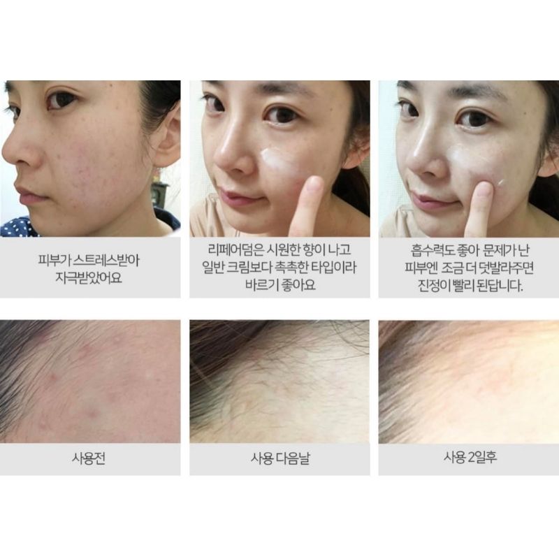 Kem phục hồi Repair Derm Cica Pro dành cho da mụn, nhạy cảm bị tổn thương