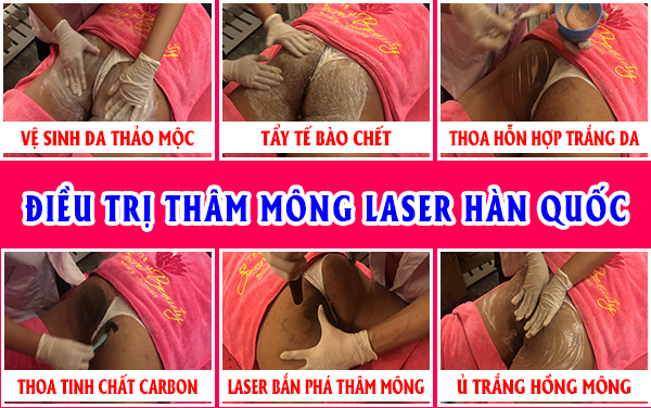 điều trị thâm mông