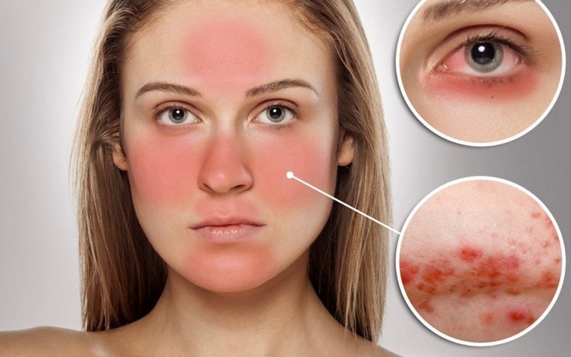 Cách thử mỹ phẩm có chứa corticoid đơn giản, chính xác nhất