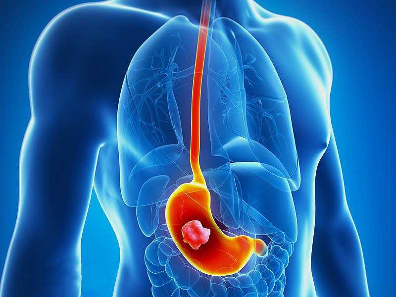 Ô nhiễm môi trường gây ra những bệnh gì