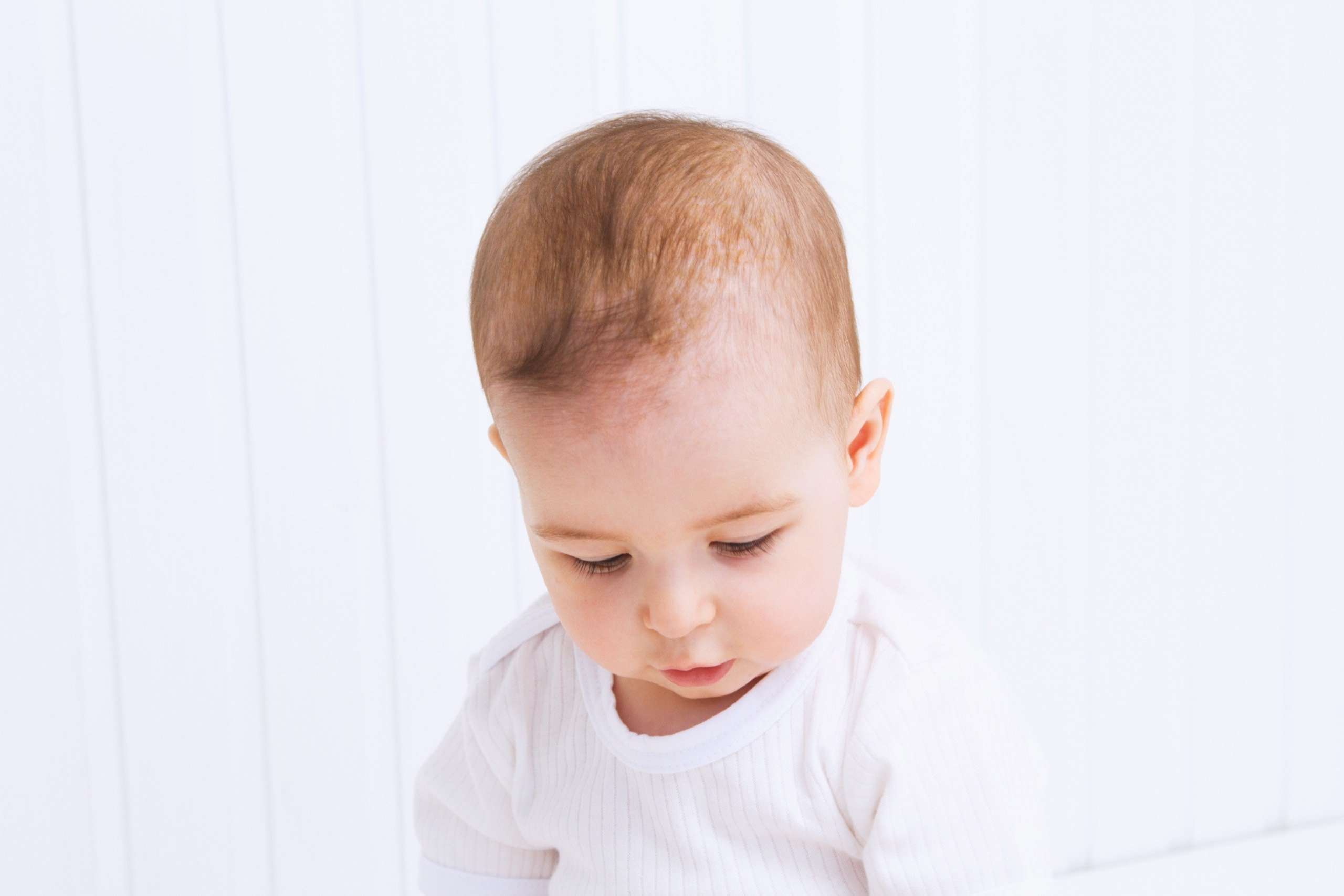 Quy trình làm sạch viêm da tiết bã nhờn cho bé sơ sinh