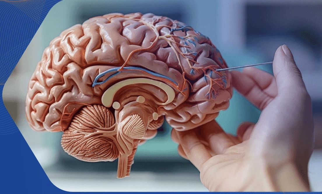GIẢI PHÁP VÀNG TRONG ĐIỀU TRỊ BỆNH ĐỘNG KINH