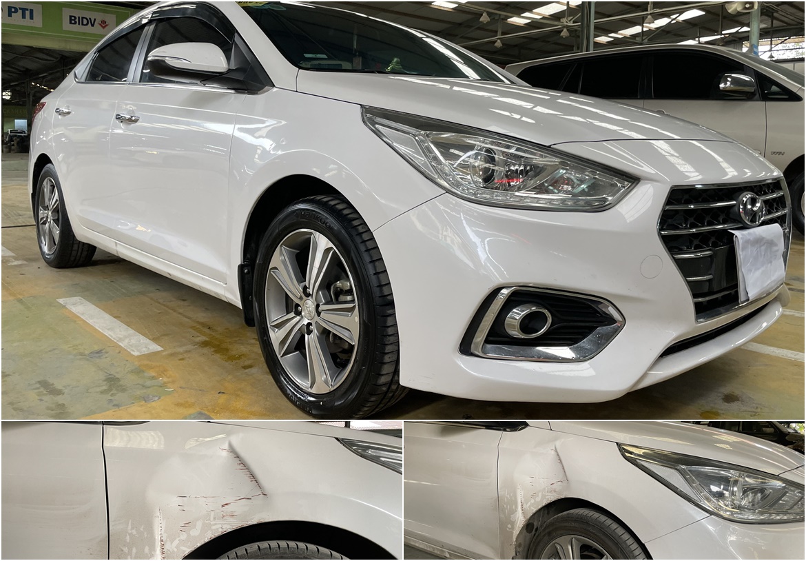 SỬA VẾT MÓP XE HYUNDAI ACCENT BỊ TAI NẠN VA CHẠM PHẦN TAI XE