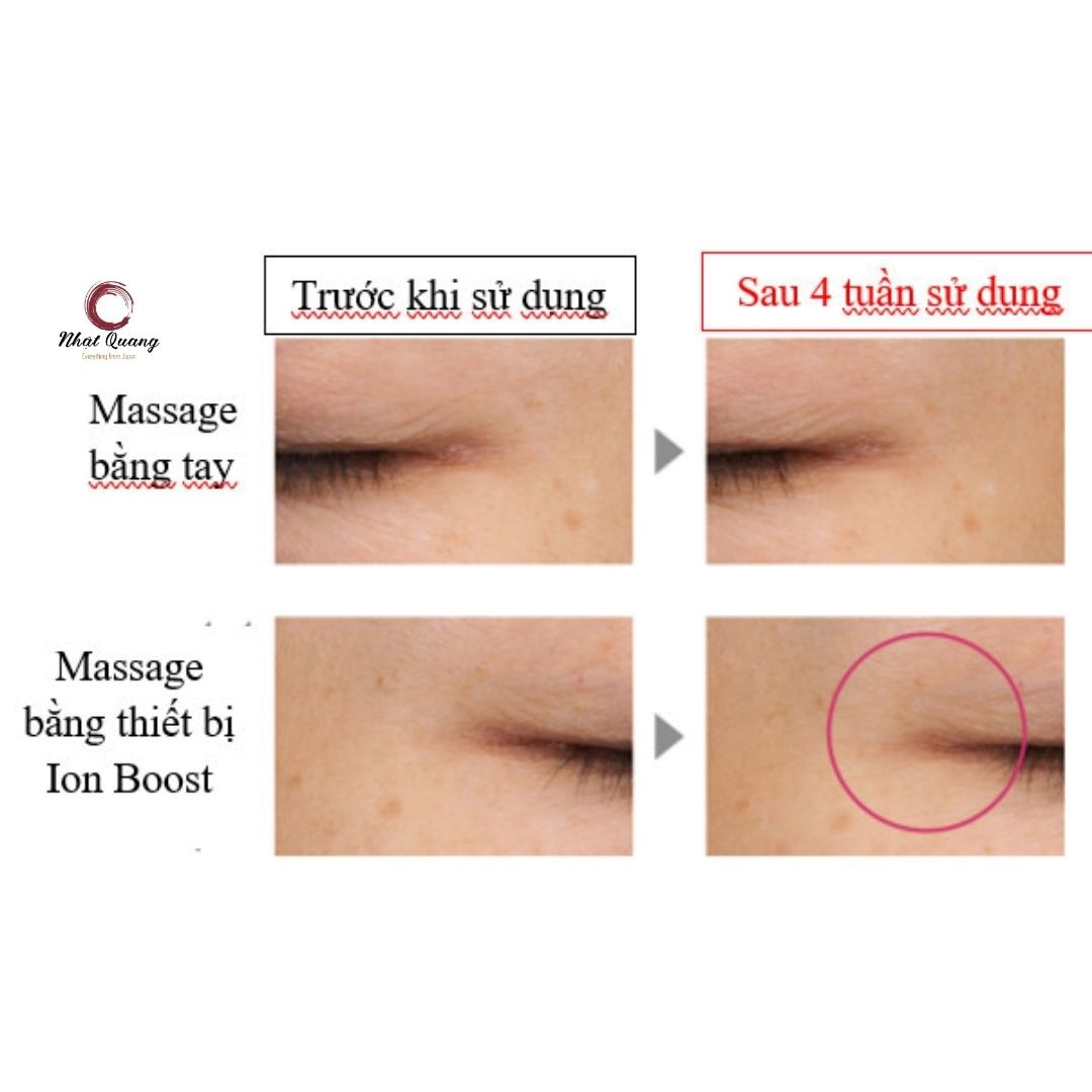 st99-nhatquang-vn-11-png