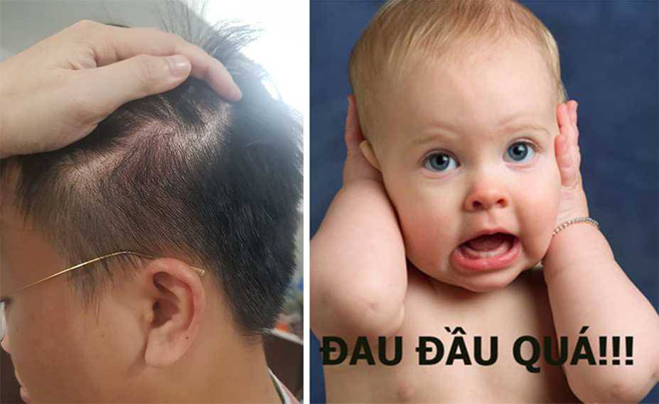 Đau đầu khi đội mũ bảo hiểm: Đội mũ bảo hiểm có thể trở nên khó chịu đôi khi, tuy nhiên, với những lời khuyên và hướng dẫn đúng cách, bạn có thể giảm thiểu sự khó chịu này. Hãy cùng xem những hình ảnh về cách giảm đau đầu khi đội mũ bảo hiểm và đảm bảo sự thoải mái khi di chuyển trên đường.