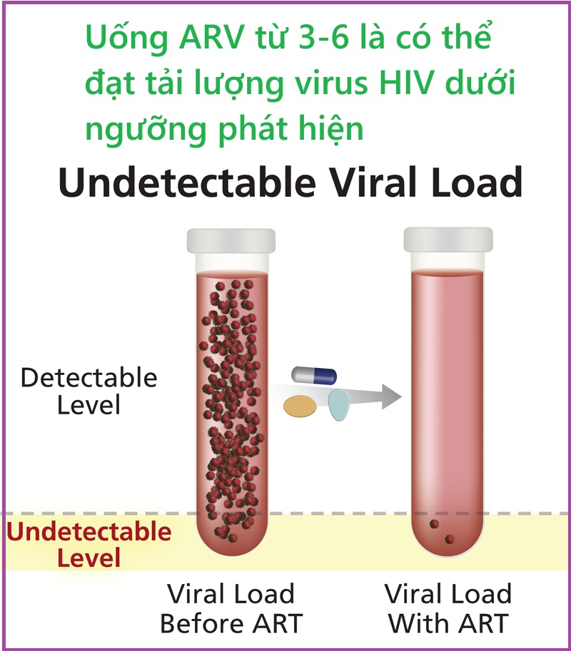Khi nào đạt tải lượng virus HIV dưới ngưỡng phát hiện? Ý nghĩa thực tiễn?