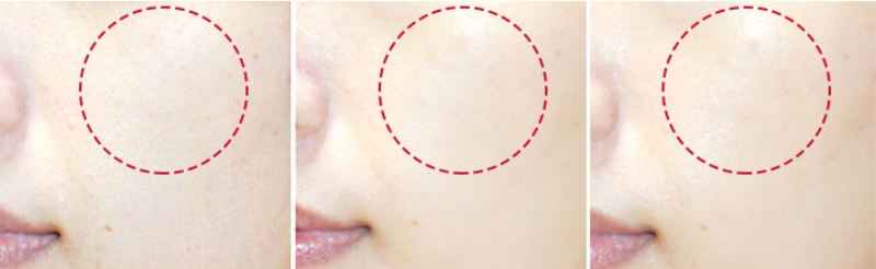 Enprani Retinoate x8 Pro Kem Làm Mềm Da Chống Nhăn