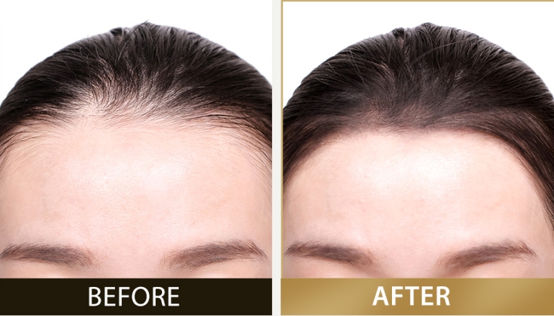 Enprani Inkronize Lasting Hair Puff 