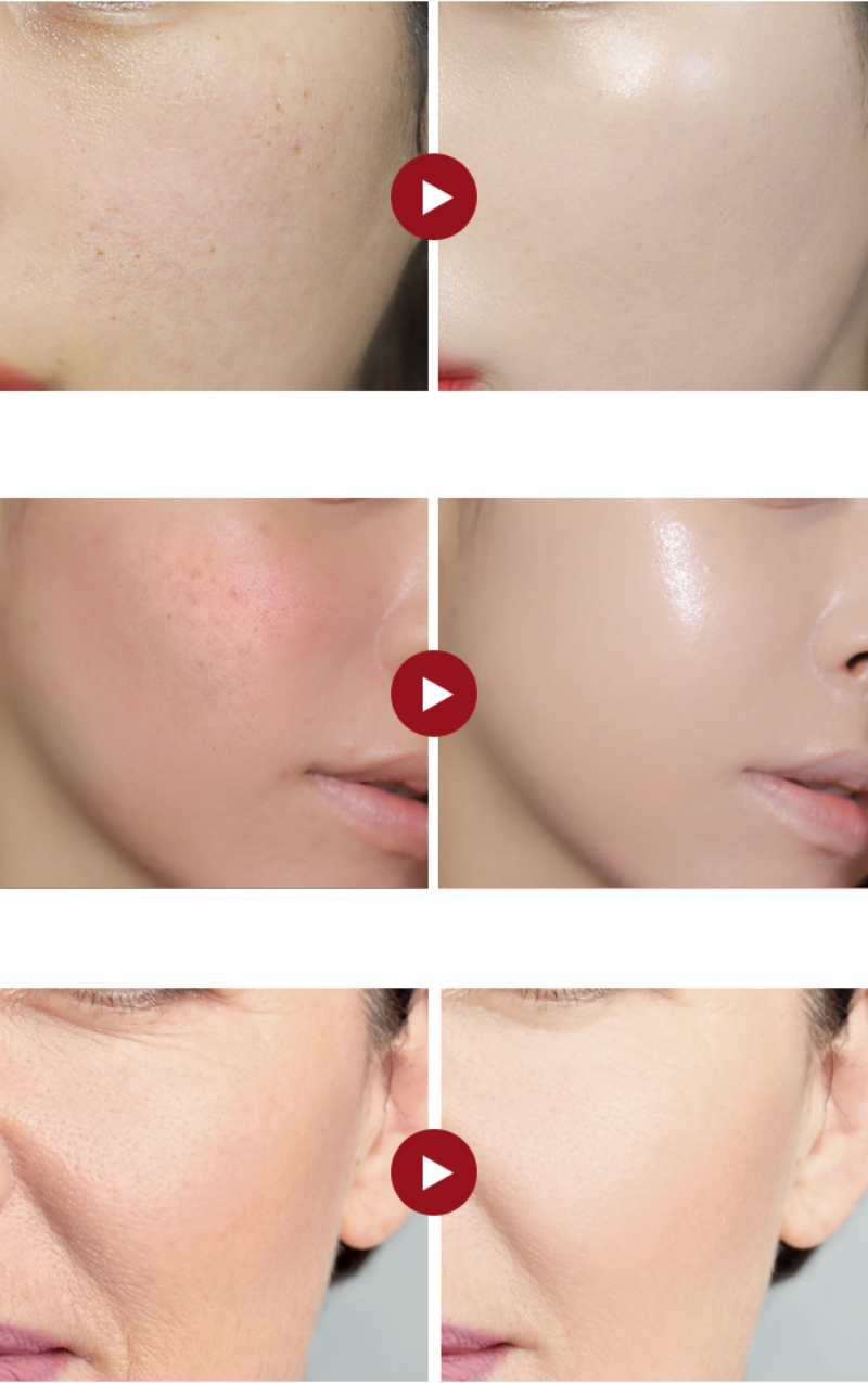 Enprani Retinoate X8 Pro Deep Wrinkle Repair Cushion