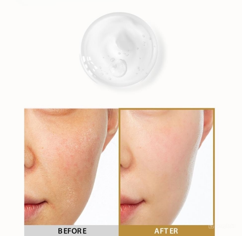 Tinh Chất Enprani Intense Ampoule