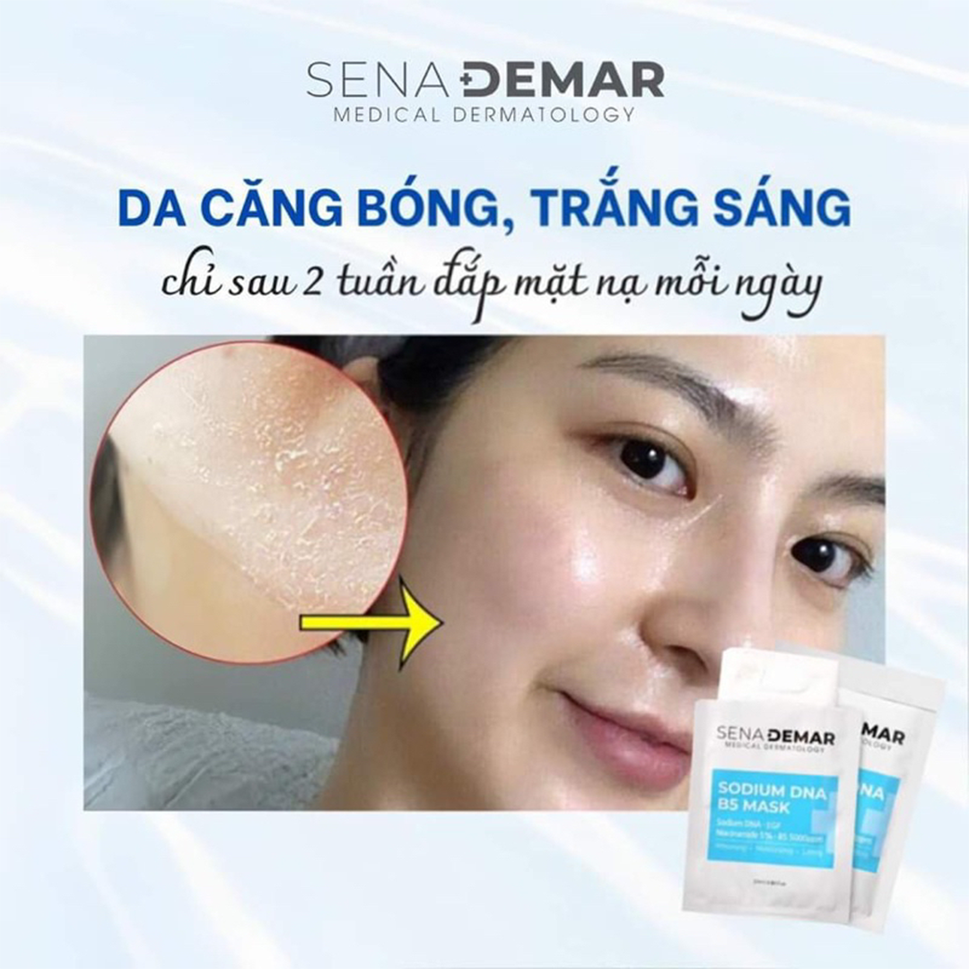 mat-na-phuc-hoi-da-sena-demar