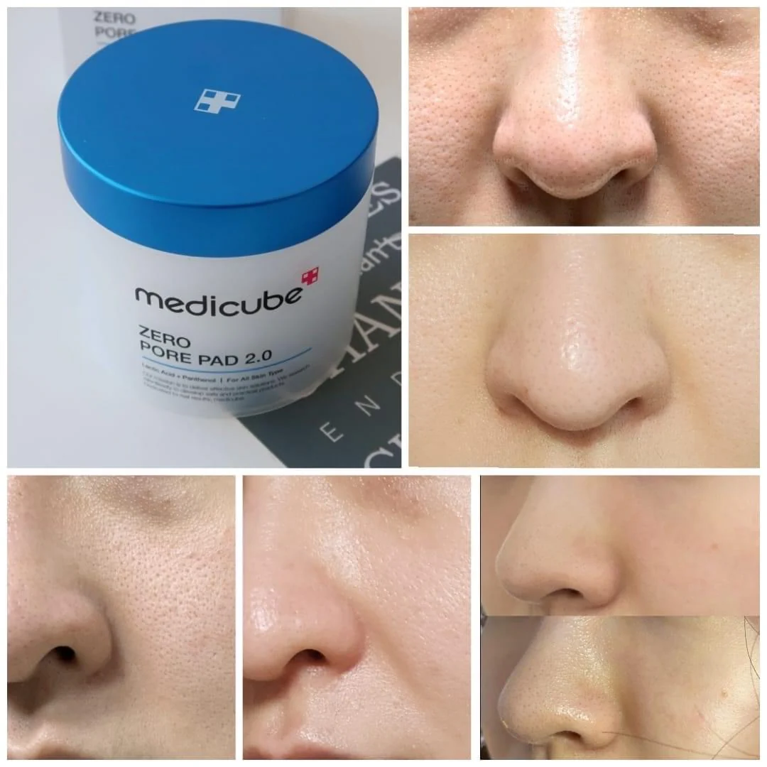 toner-pad-medicube