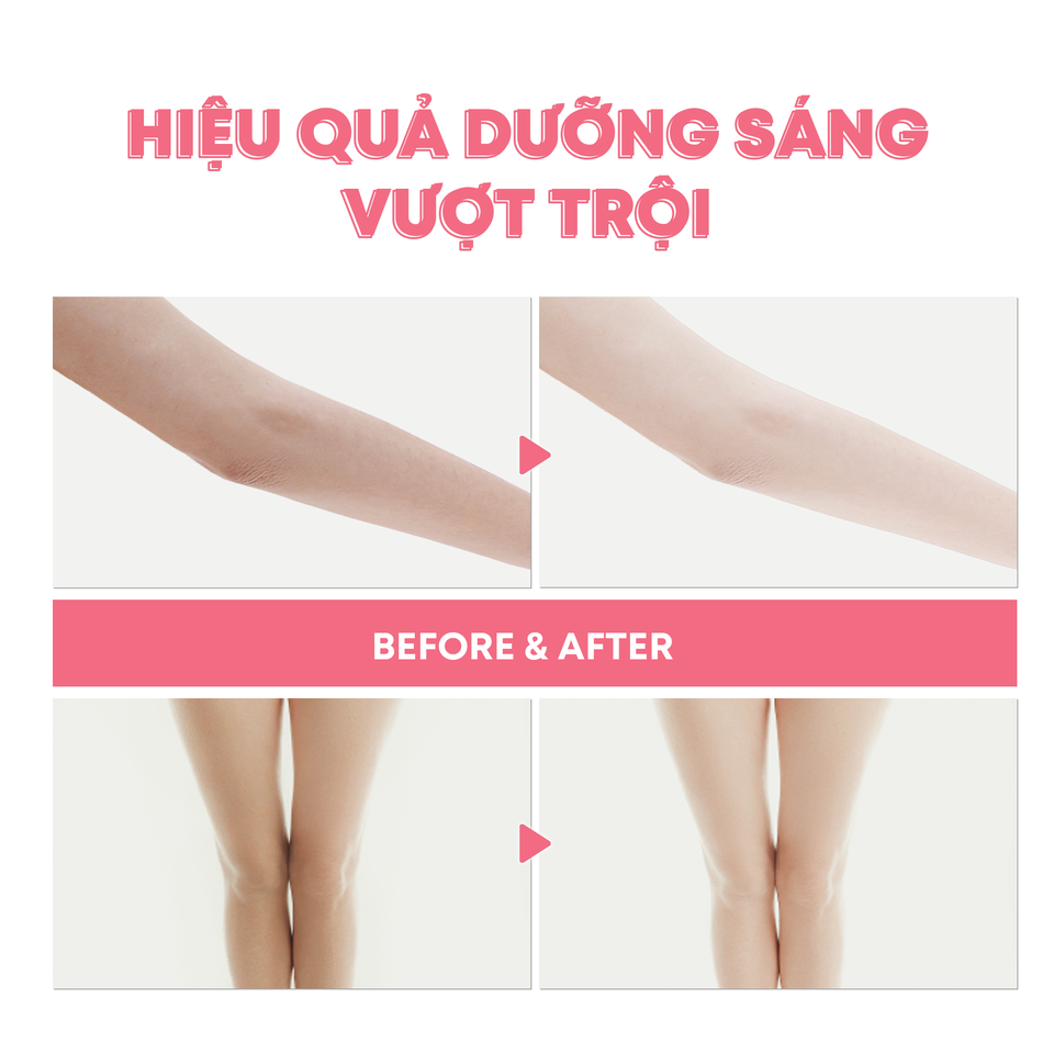 duong-the-trang-da-whisis