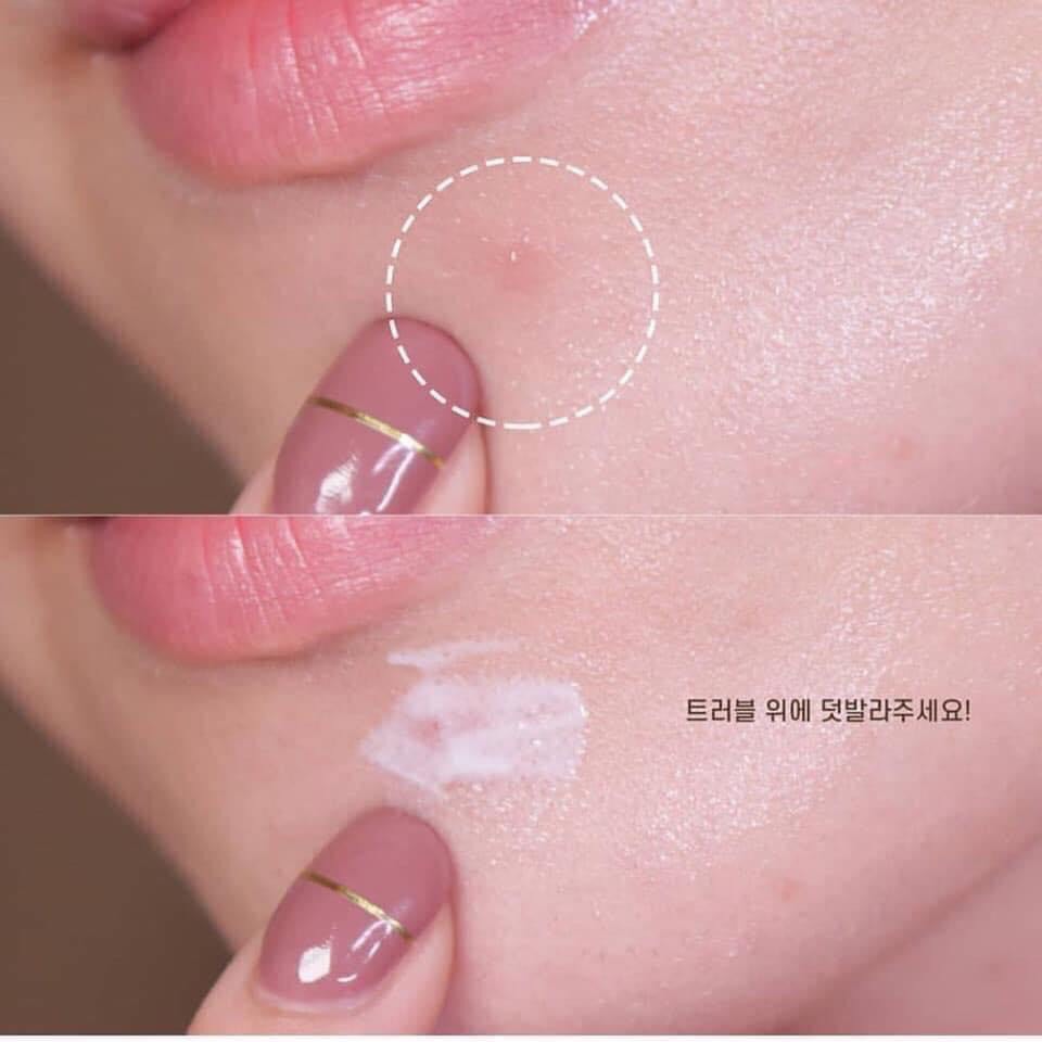kem-duong-phuc-hoi-da-bioderma