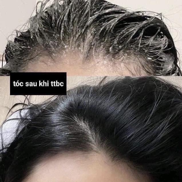 tay-te-bao-chet-da-dau-aromatica