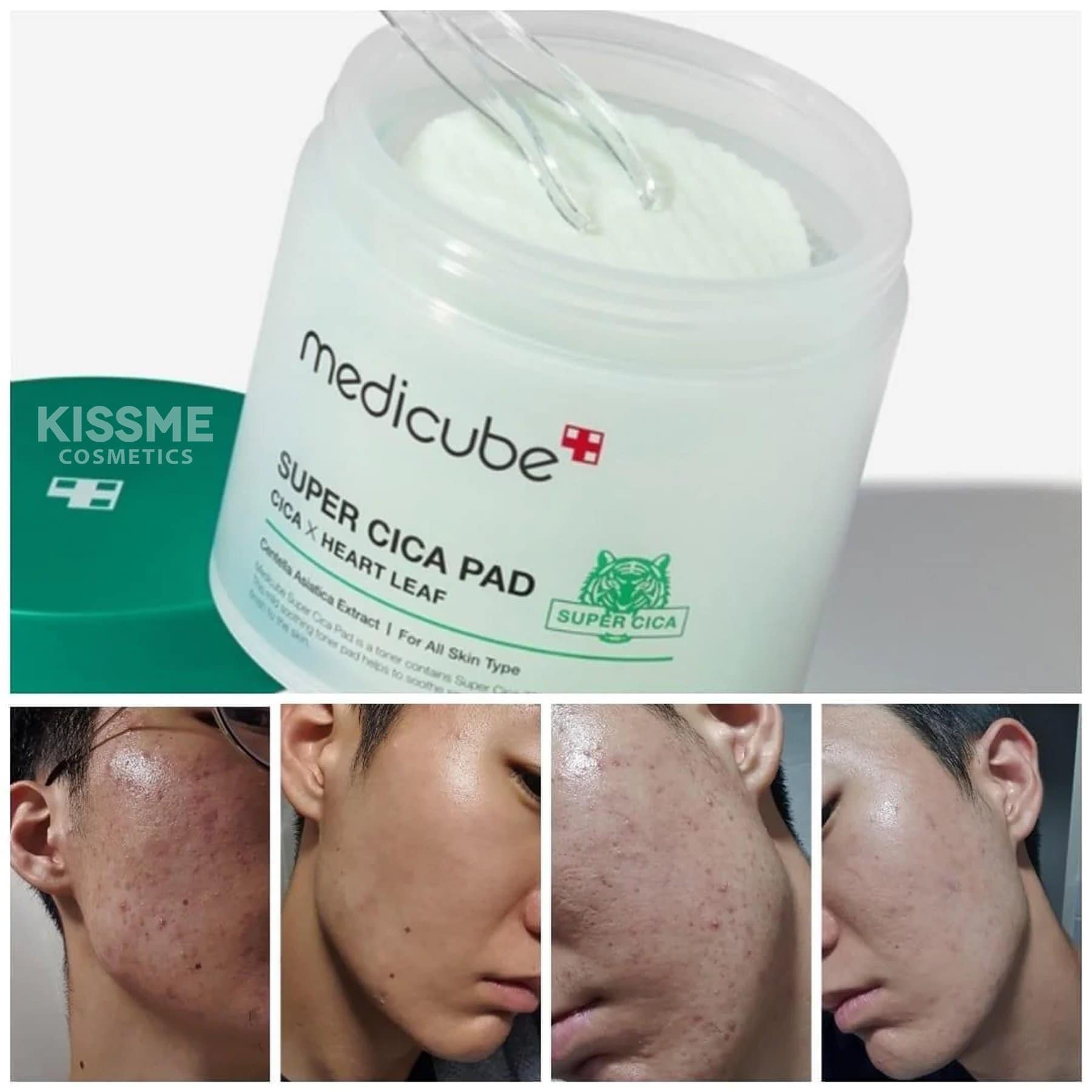 toner-pad-medicube