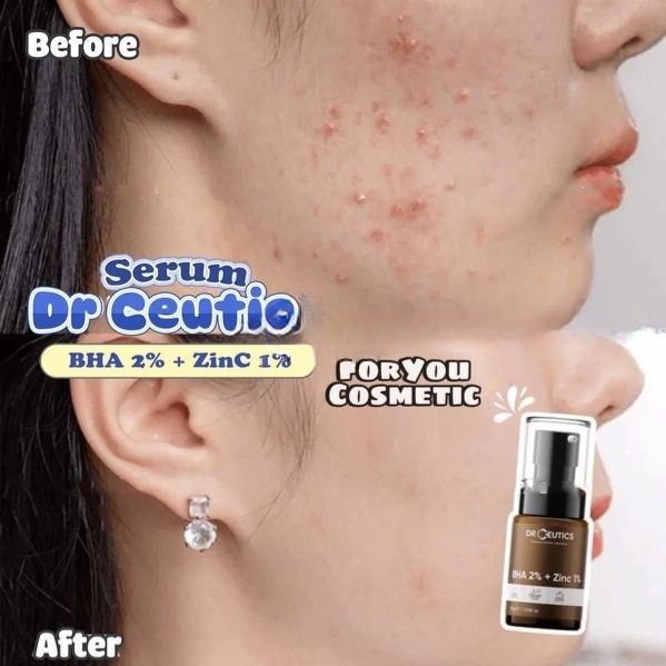 serum-tay-te-bao-chet-bha-drceutics