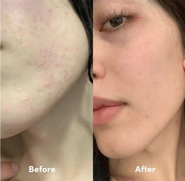 serum-kiem-dau-sang-da-drceutics-niacinamide