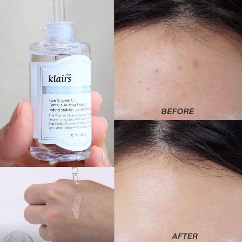 serum-duong-sang-mo-tham-klairs-juiced-vitamin