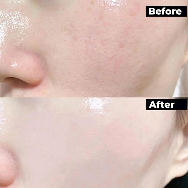 serum-kiem-dau-sang-da-drceutics-niacinamide