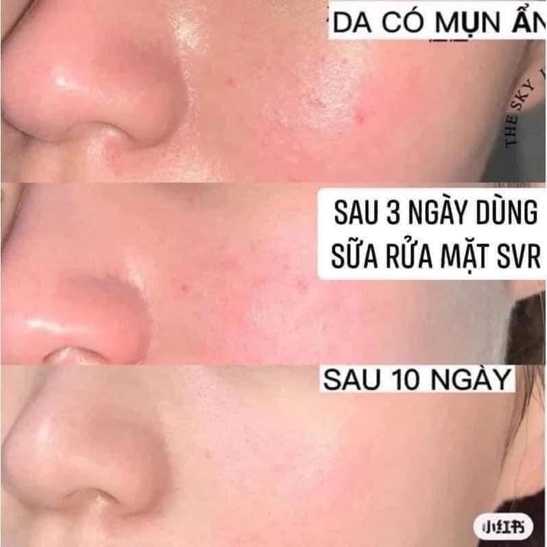 sua-rua-mat-da-nhay-cam-svr-hong-topialyse-gel-lavant