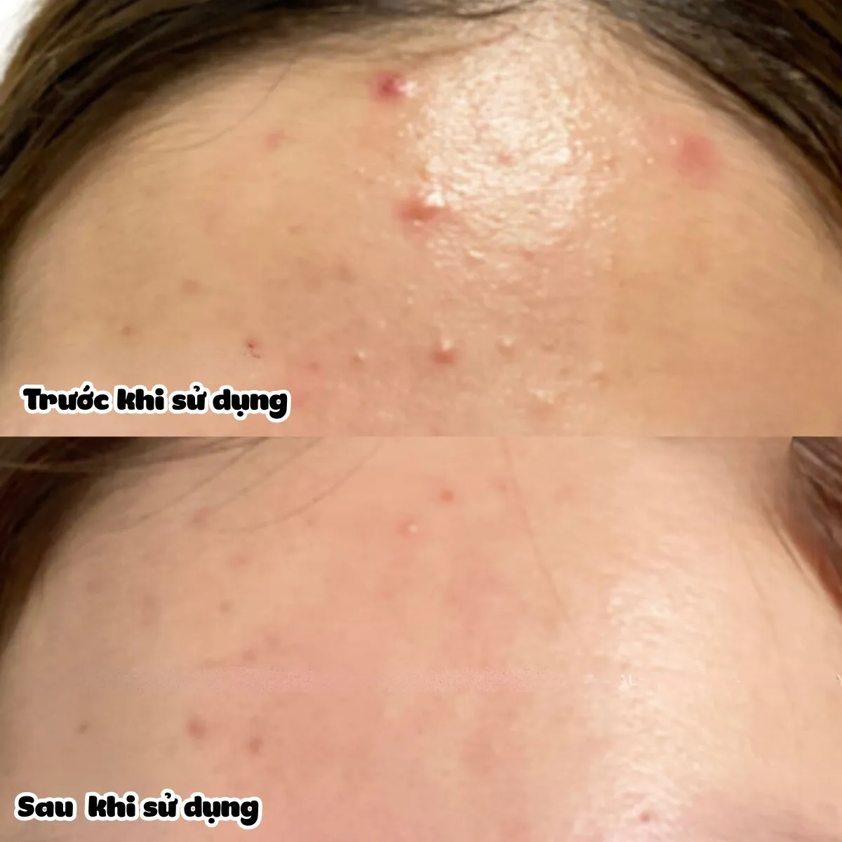 toner-bha-drceutics-alcohol