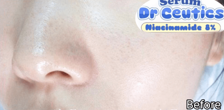 serum-kiem-dau-sang-da-drceutics-niacinamide-8
