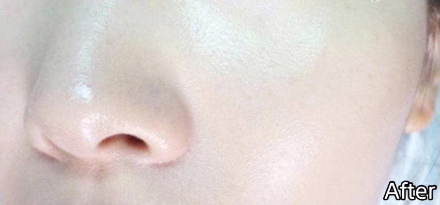 serum-kiem-dau-sang-da-drceutics-niacinamide-8