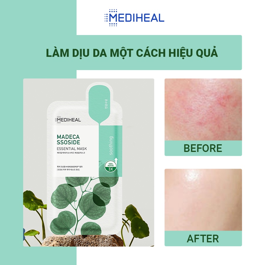 https://myphamkissme.com/mat-na-giay-duong-da-mediheal-essential-mask