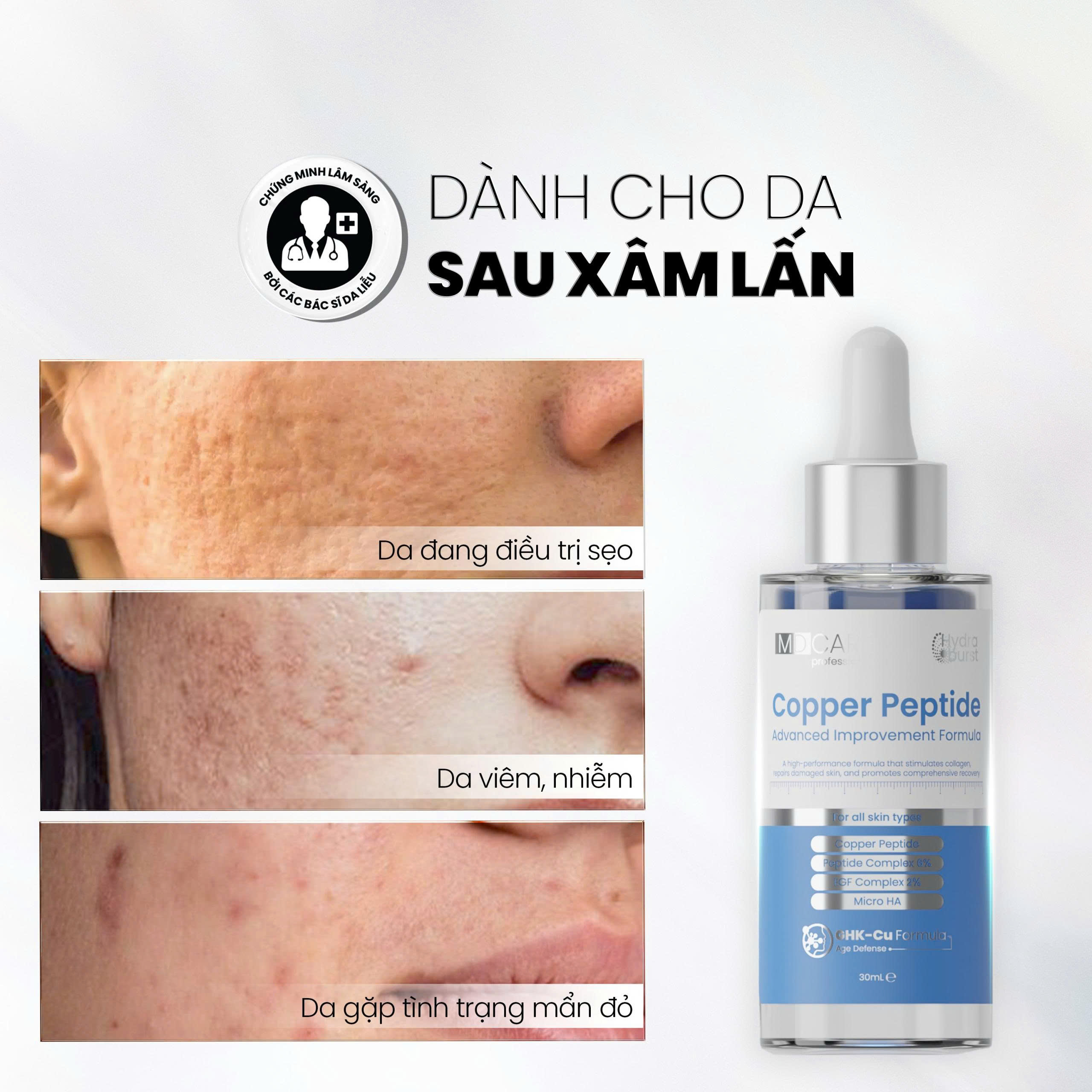 Tinh Chất MD CARE Copper Peptide Serum