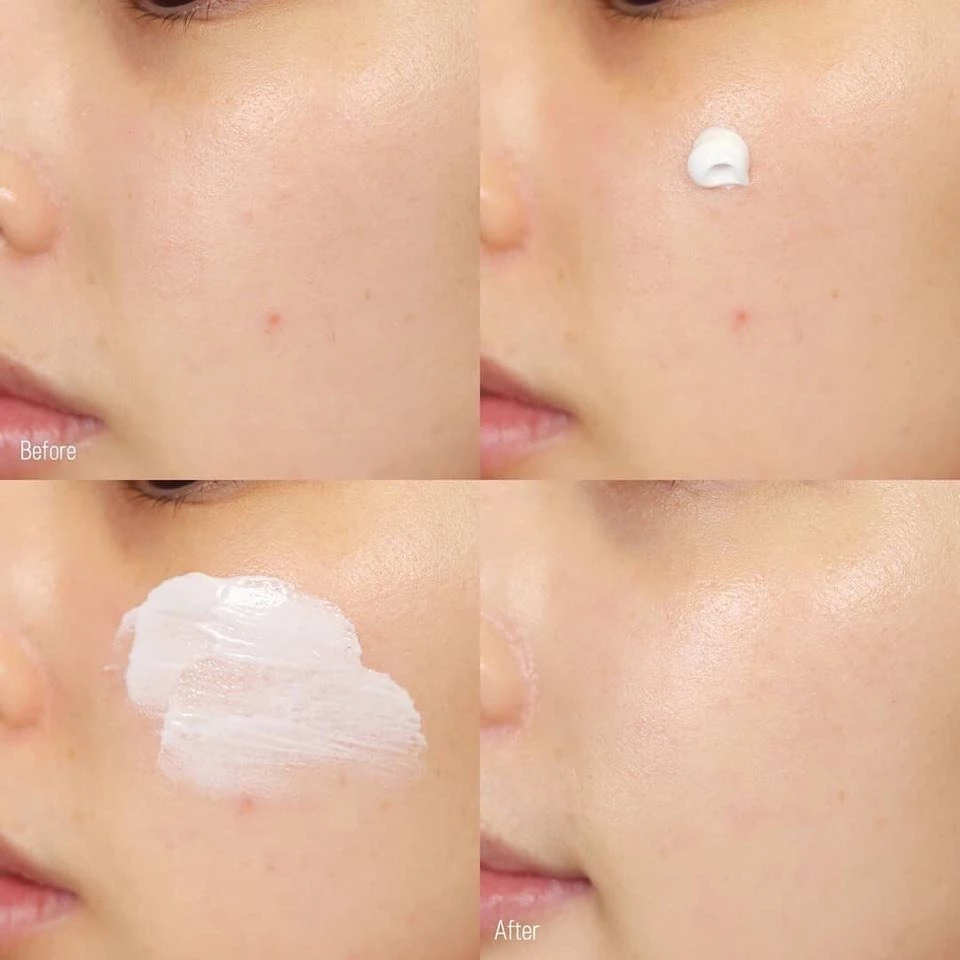 kem-duong-phuc-hoi-da-laroche-posay-b5+