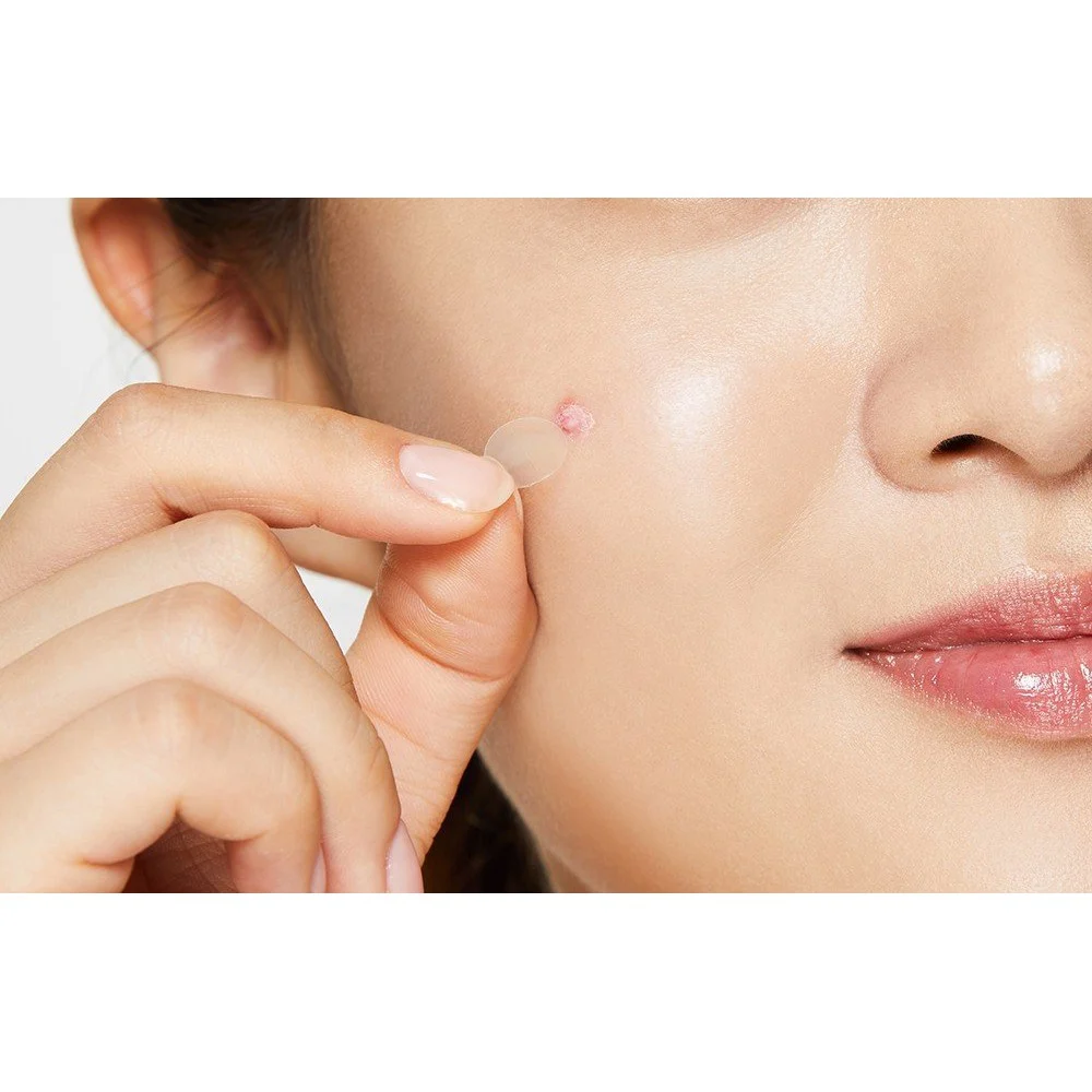 mieng-dan-mun-sieu-mong-cosrx-mau-den