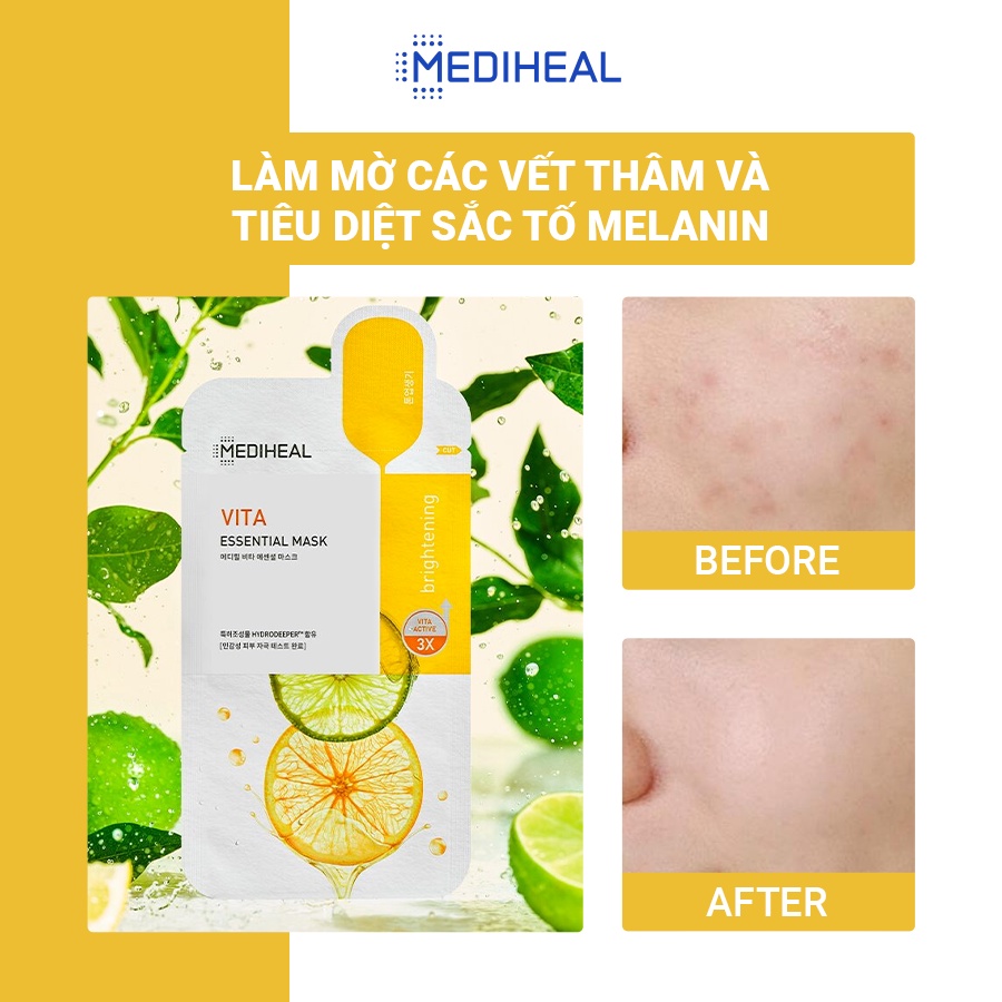 https://myphamkissme.com/mat-na-giay-duong-da-mediheal-essential-mask