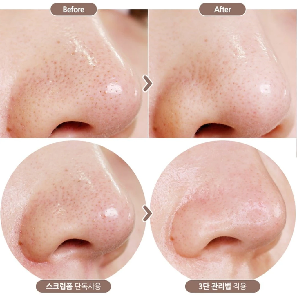 sua-rua-mat-cho-da-dau-innisfree-volcanic-bha