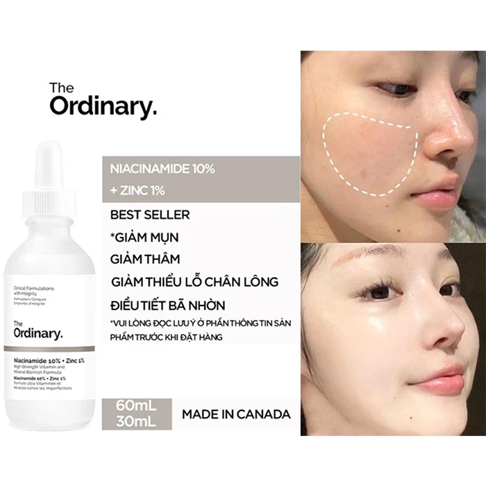 serum-tri-mun-va-giam-tham-the-ordinary-niacinamide-10-zinc-1