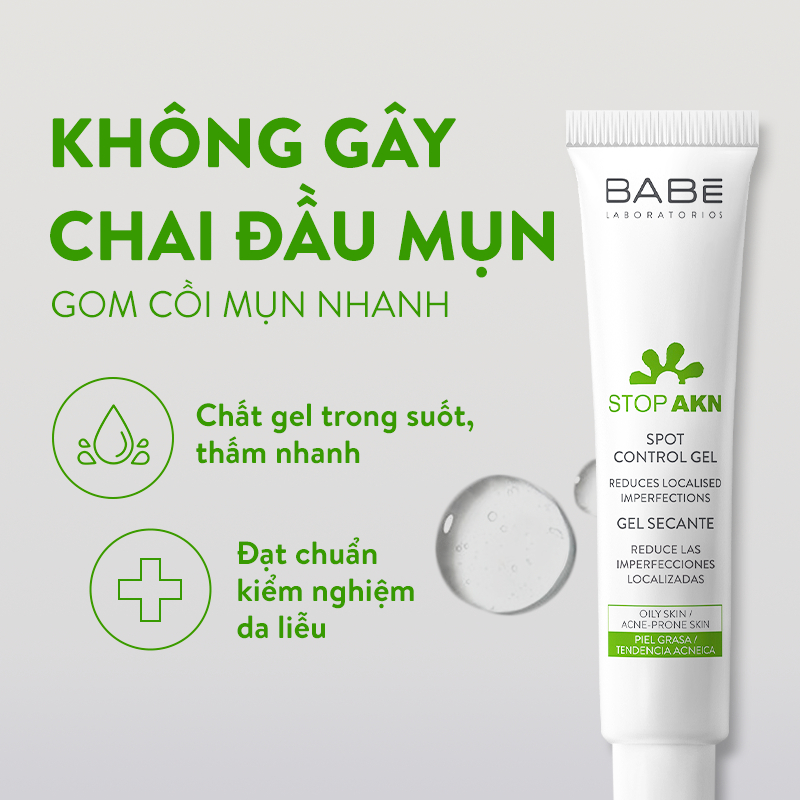 https://myphamkissme.com/gel-cham-mun-giam-viem-sung-babe-stop-akn-spot-control-gel