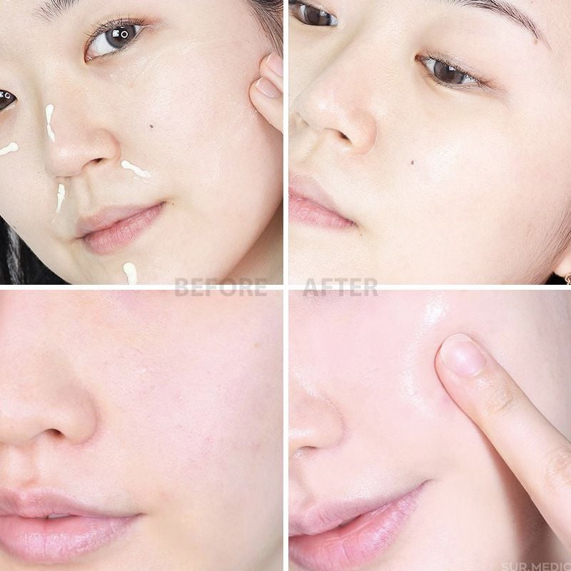 https://myphamkissme.com/kem-duong-tai-tao-phuc-hoi-da-sur-medic-peptide