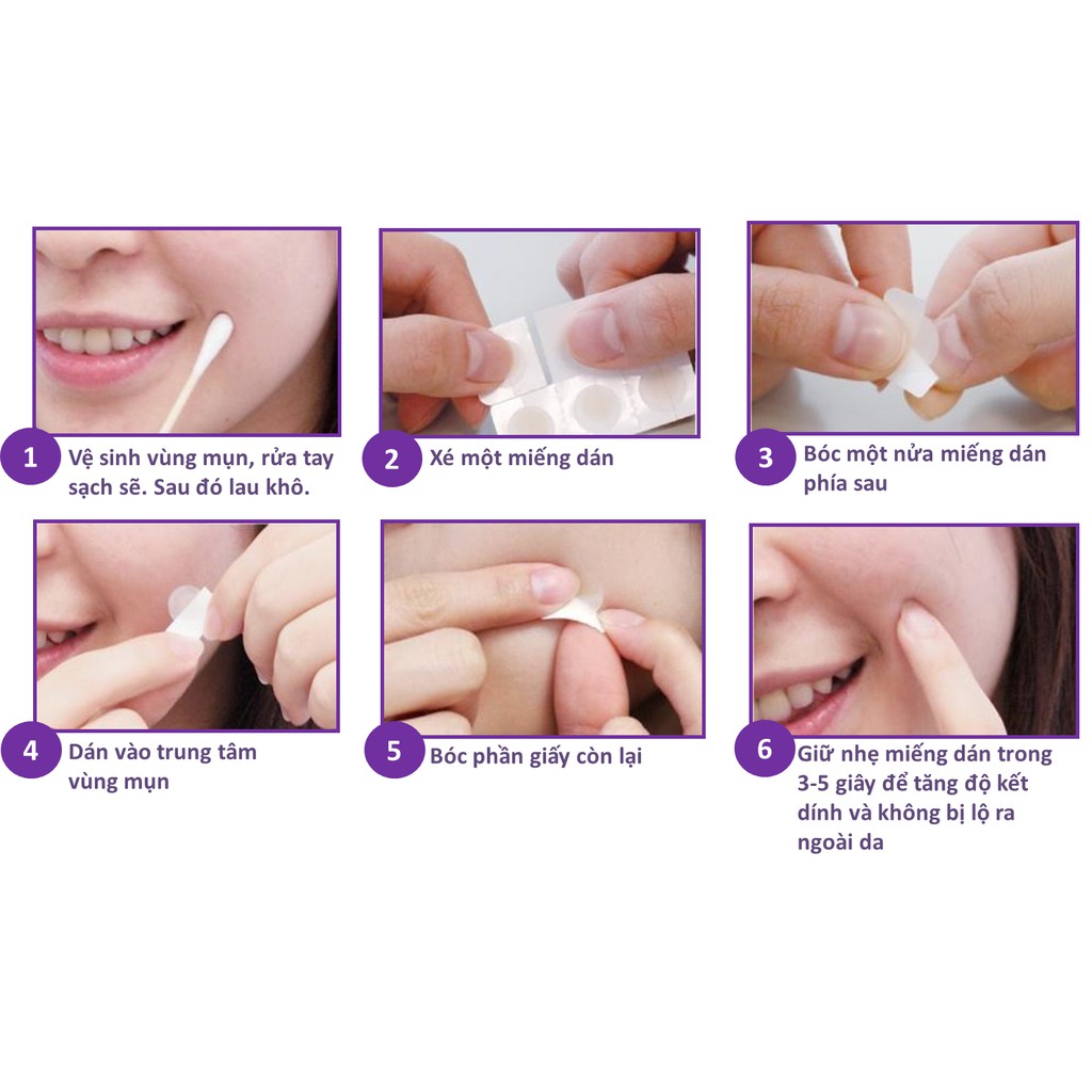 https://myphamkissme.com/mieng-dan-mun-acnes-clear-patch