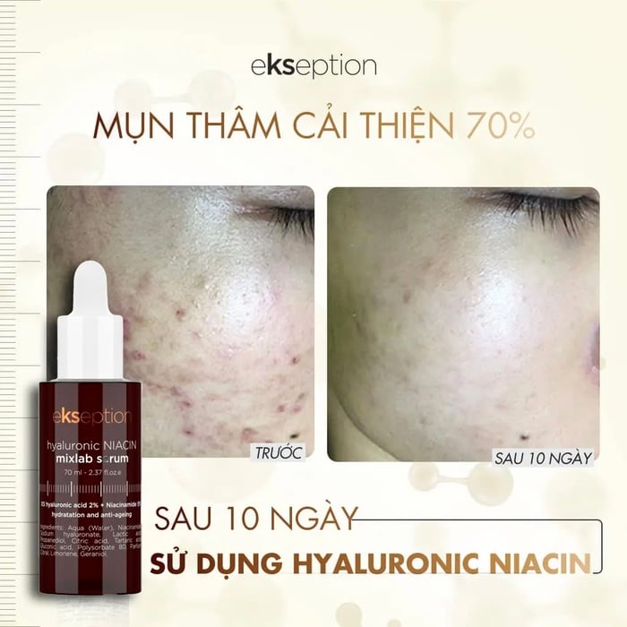 https://myphamkissme.com/tinh-chat-ekseption-hyaluronic-niacin-mixlab-serum