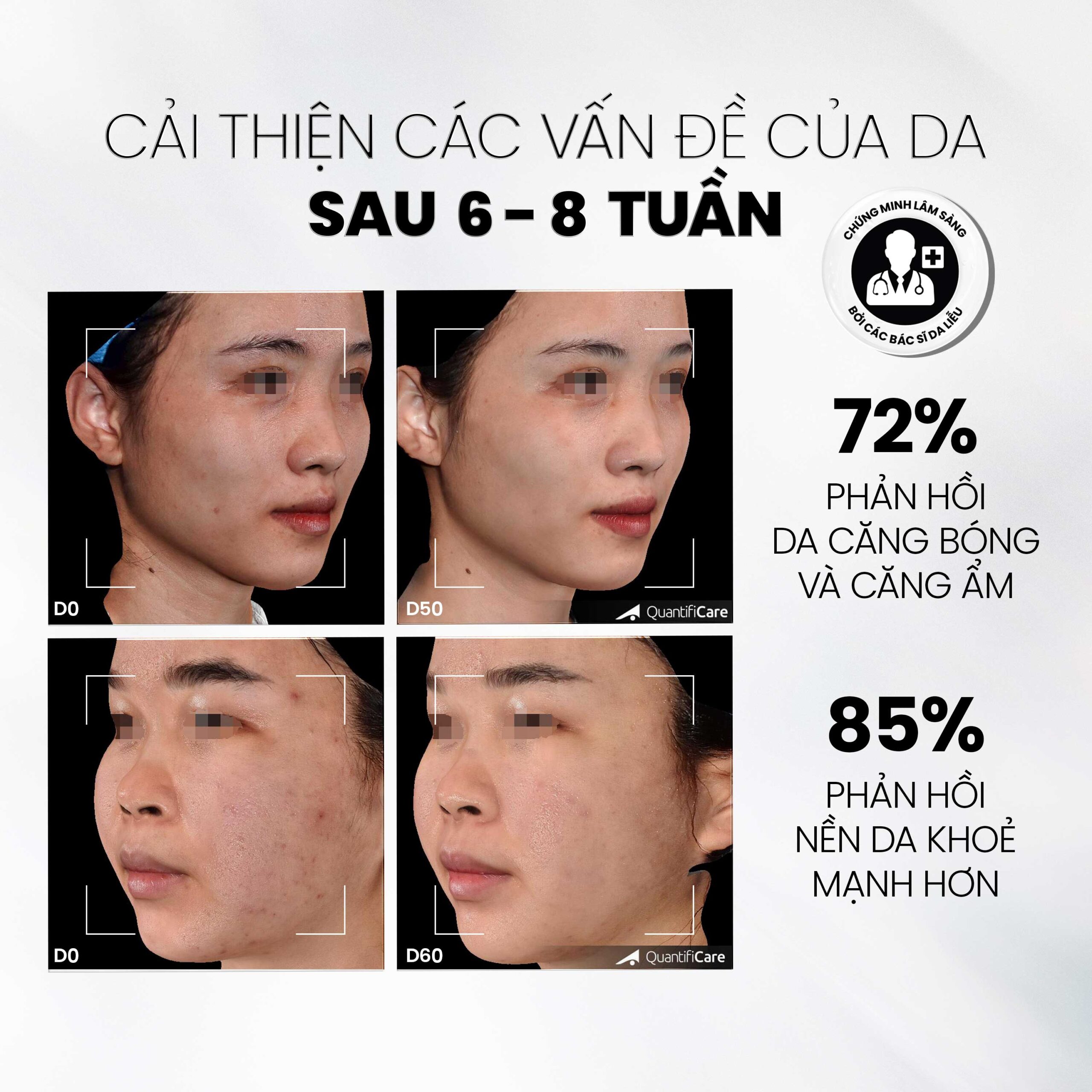 tẩy tế bào chết MD CARE Mande Exfo