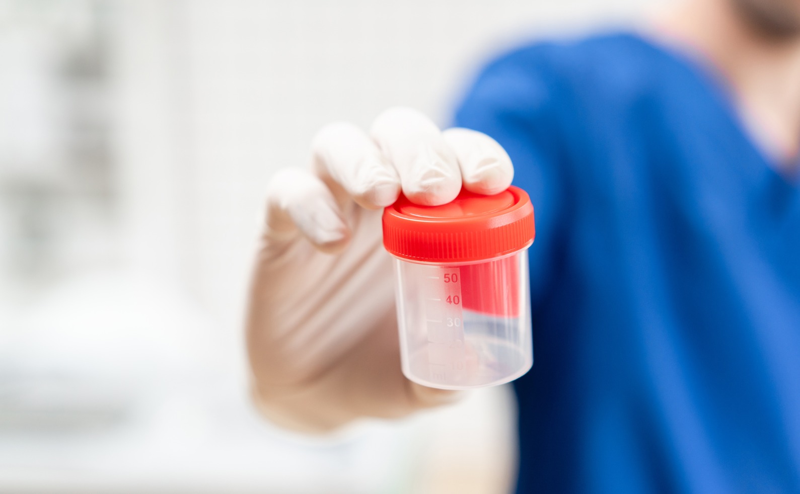 Xuất Tinh Màu Hồng Ở Nam Giới: Tại Sao Xảy Ra Và Làm Sao Để Điều Trị?