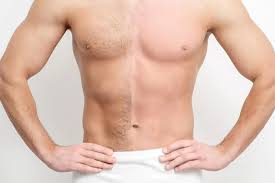 Nam Giới Có Nên Tỉa Lông Vùng Kín Không? Lợi Ích, Rủi Ro Và Cách Làm An Toàn